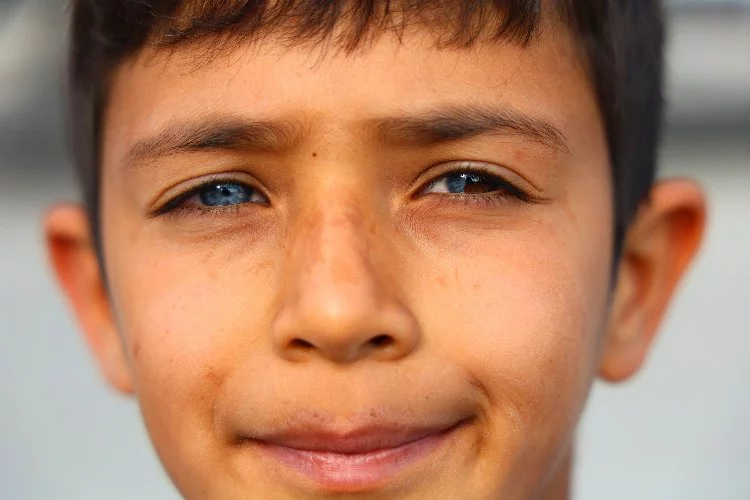 Adana’da bu çocuk görenleri şaşırtıyor: Hayata çift renk bakıyor