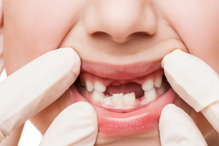 Özel durumu olan çocuklara sorunsuz diş tedavisi