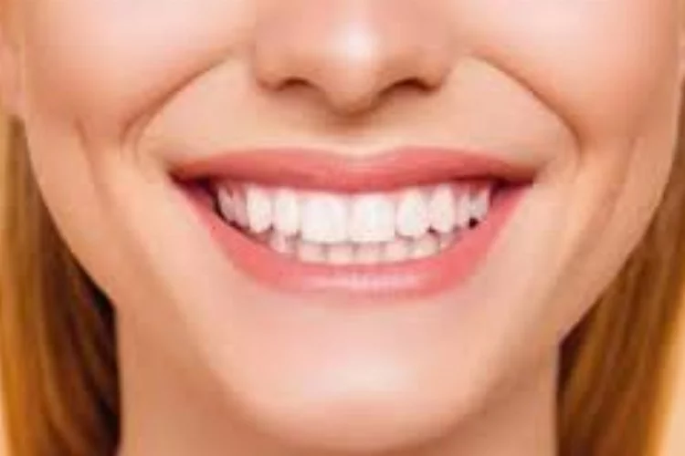 Diş taşının temizlenmemesi diş kaybına yol açabiliyor