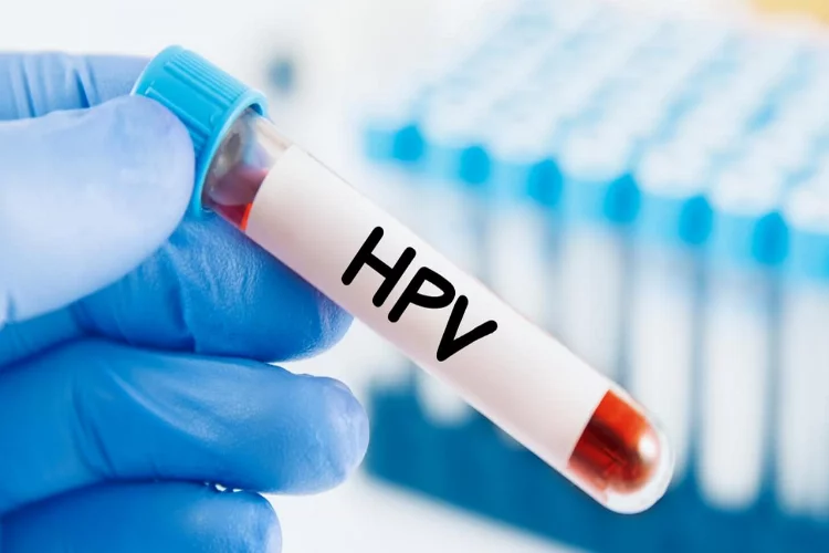 HPV virüsü nedir? HPV belirtileri nelerdir?